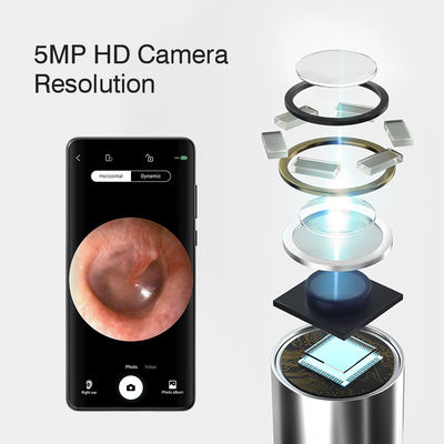 Máy loại bỏ sáp tai bằng điện với máy ảnh otoscope không dây và pin sạc lại