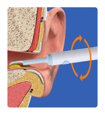 Smart Visual Ear Cleaning Rod Camera Medical Endoscope cho các hóa chất gia đình khác
