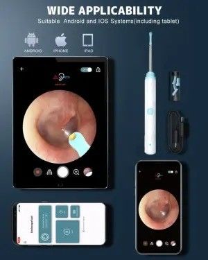 Bộ dụng cụ loại bỏ sáp tai làm sạch gia đình với máy ảnh và ánh sáng làm sạch tai Otoscope 1296P